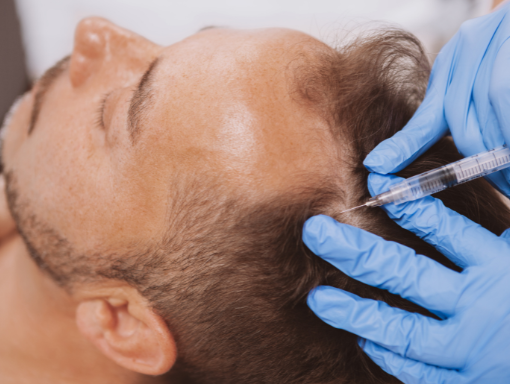 Services PRP for Hair Loss for Men
