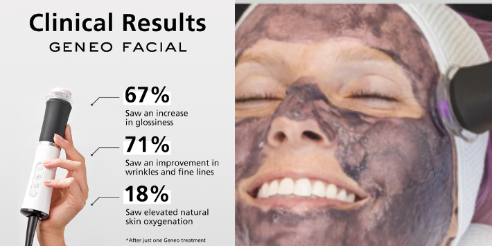 Geneo Oxygen Facial results